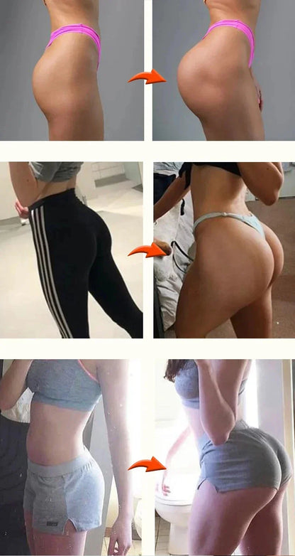 🌟 Nice Curves – Butt Enhancement Cream 🌟