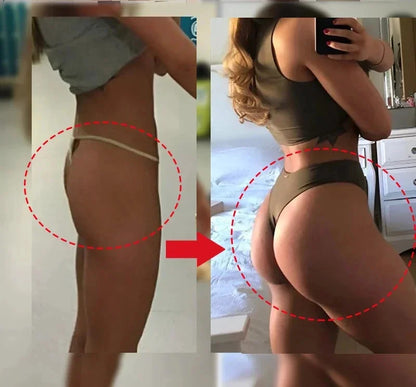 🌟 Nice Curves – Butt Enhancement Cream 🌟